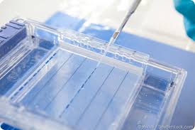 Polyacrylamide Gel